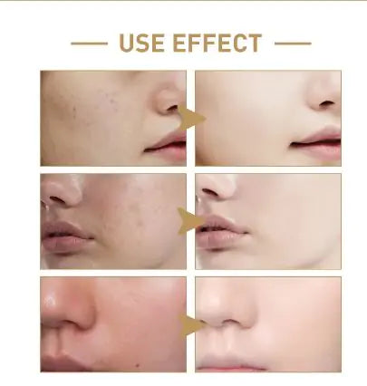Rice Face Toner - Hydrating &amp; Moisturizing